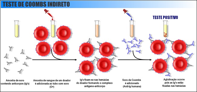 Teste de Coombs Indireto | Biomedicina Padrão
